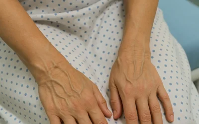 Paciente joven con celulitis y acceso venoso periférico favorable